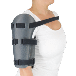 Νάρθηκας Κατάγματος Διάφυσης Βραχιονίου