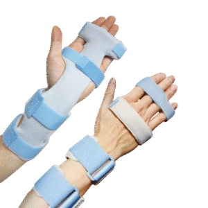 Πηχεοκαρπικός Νάρθηκας Άκρας Χειρός