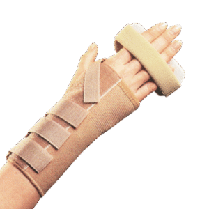 Νάρθηκας Καρπού - Δακτύλων